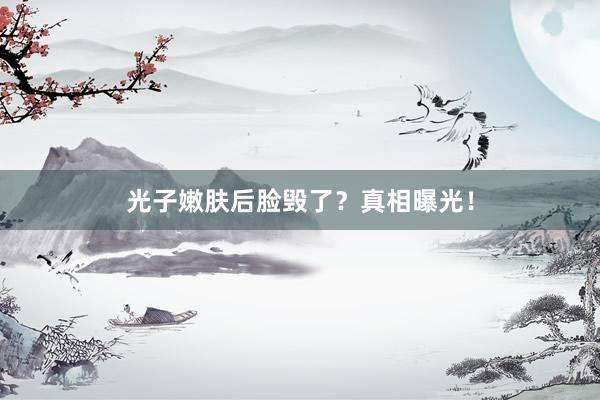 光子嫩肤后脸毁了？真相曝光！